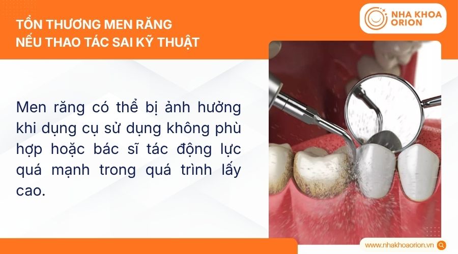 Tổn thương men răng nếu thao t&aacute;c sai kỹ thuật