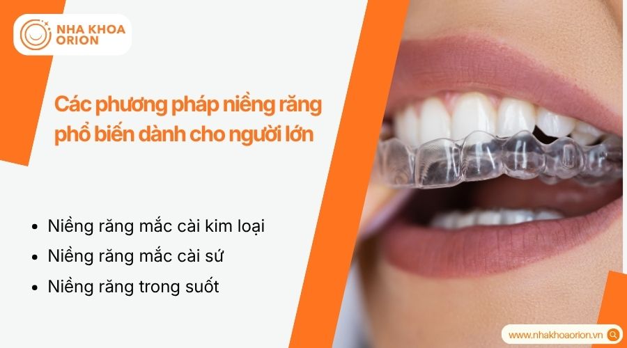 Mỗi phương ph&aacute;p niềng răng ph&ugrave; hợp với từng nhu cầu v&agrave; t&igrave;nh trạng