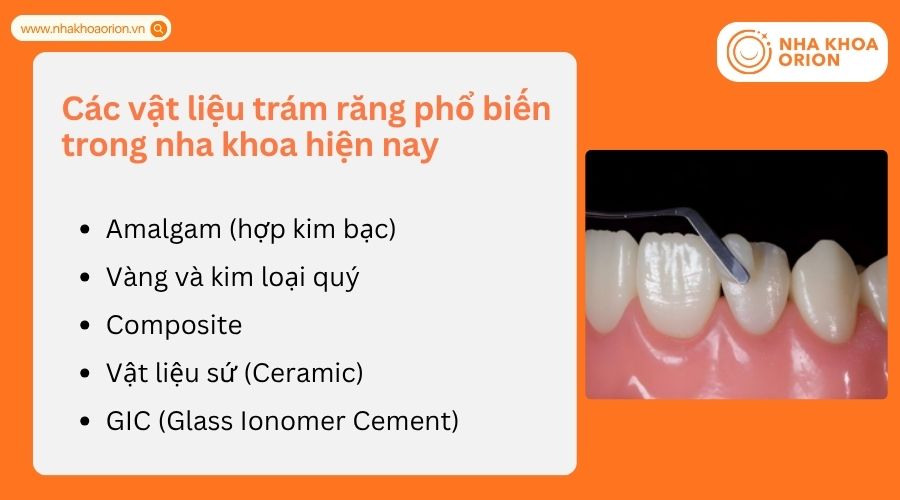 Mỗi vật liệu c&oacute; đặc điểm ri&ecirc;ng về độ bền, thẩm mỹ v&agrave; chi ph&iacute;