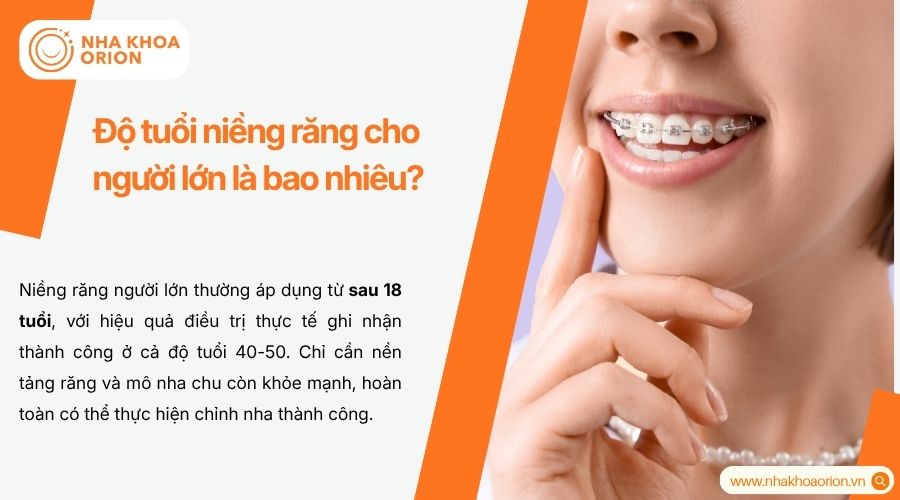 Niềng răng cho người lớn thường được &aacute;p dụng cho người 18 tuổi trở l&ecirc;n
