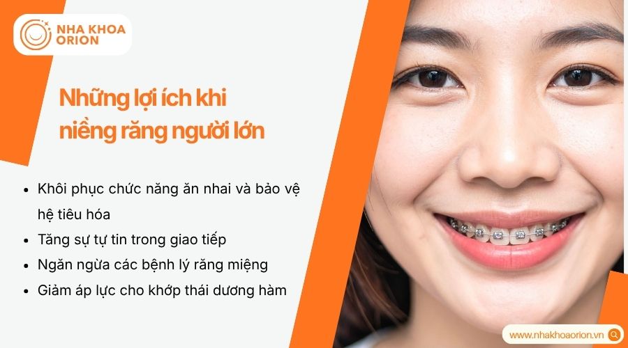 Niềng răng gi&uacute;p cải thiện thẩm mỹ v&agrave; chức năng ăn nhai r&otilde; rệt