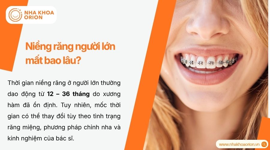 Thời gian niềng răng phụ thuộc độ tuổi v&agrave; mức độ sai lệch răng