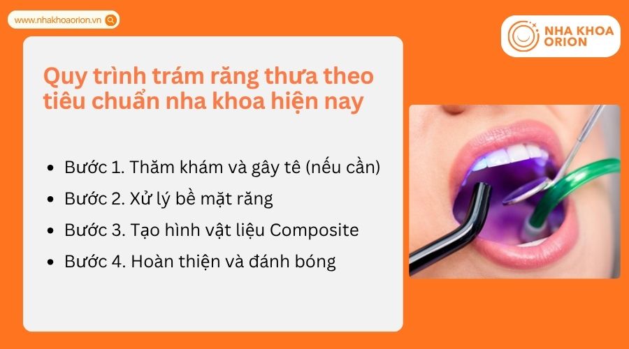 Quy tr&igrave;nh tr&aacute;m răng gồm nhiều bước nhằm đảm bảo độ bền v&agrave; thẩm mỹ