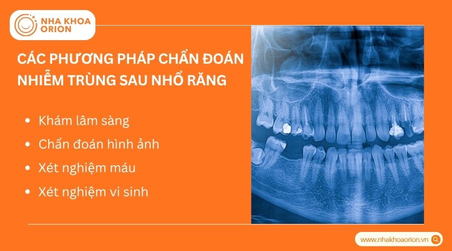 B&aacute;c sĩ sử dụng nhiều phương ph&aacute;p để x&aacute;c định mức độ nhiễm tr&ugrave;ng