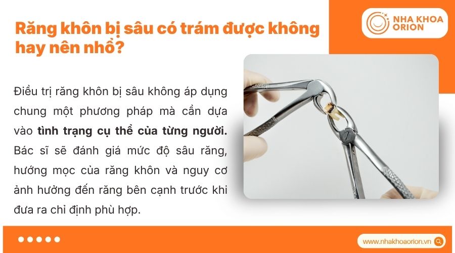 Việc nhổ răng kh&ocirc;n bị s&acirc;u phụ thuộc mức độ tổn thương v&agrave; chỉ định b&aacute;c sĩ