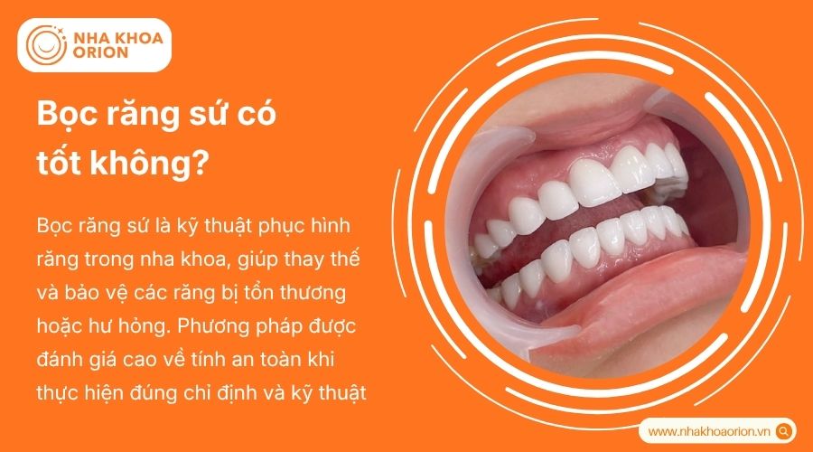 Bọc răng sứ mang lại hiệu quả thẩm mỹ v&agrave; phục hồi chức năng ăn nhai