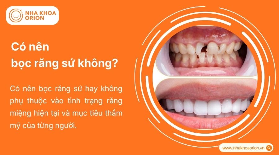 Bọc răng sứ ph&ugrave; hợp với c&aacute;c trường hợp răng tổn thương hoặc mất thẩm mỹ