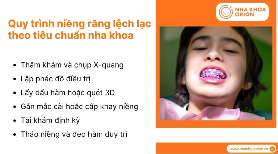 Quy tr&igrave;nh chỉnh nha cần thực hiện đ&uacute;ng chuẩn để đảm bảo hiệu quả v&agrave; an to&agrave;n