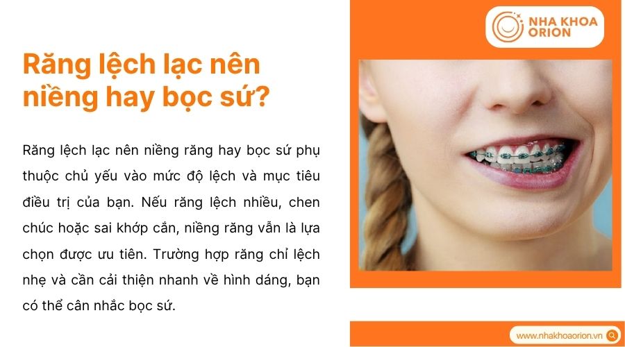 Niềng răng hay bọc sứ cho răng lệch lạc t&ugrave;y mức độ v&agrave; mục ti&ecirc;u thẩm mỹ