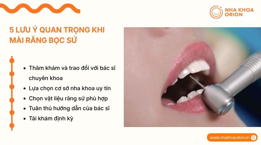 Cần thăm kh&aacute;m, chọn nha khoa uy t&iacute;n v&agrave; tu&acirc;n thủ hướng dẫn khi m&agrave;i răng bọc sứ