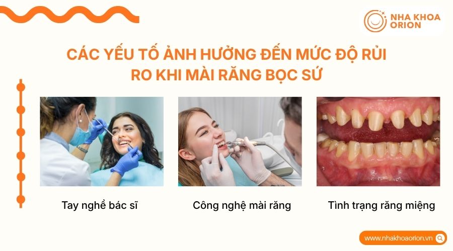 Mức độ rủi ro phụ thuộc v&agrave;o tay nghề b&aacute;c sĩ, c&ocirc;ng nghệ v&agrave; t&igrave;nh trạng răng miệng