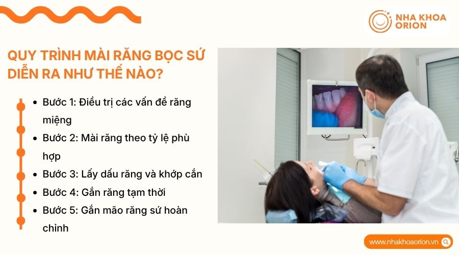 Quy tr&igrave;nh 5 bước m&agrave;i răng bọc sứ chuẩn y khoa