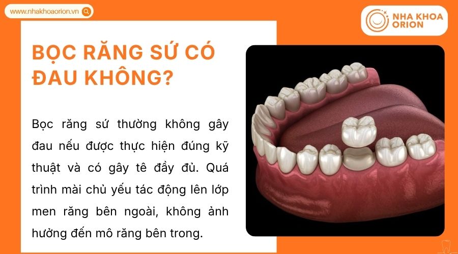 Bọc răng sứ đ&uacute;ng kỹ thuật c&oacute; g&acirc;y t&ecirc;, m&agrave;i &iacute;t men răng n&ecirc;n kh&ocirc;ng g&acirc;y đau nhiều