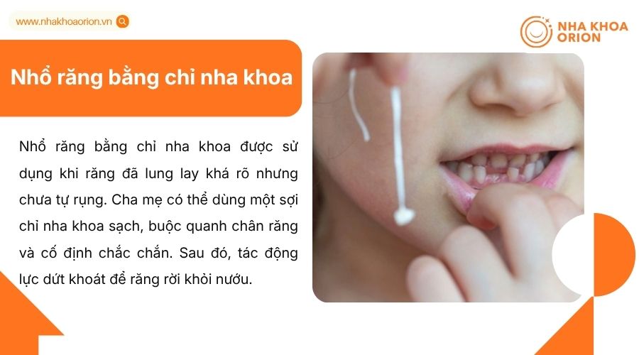Nhổ răng bằng chỉ nha khoa &aacute;p dụng khi răng lung lay r&otilde; nhưng chưa tự rụng