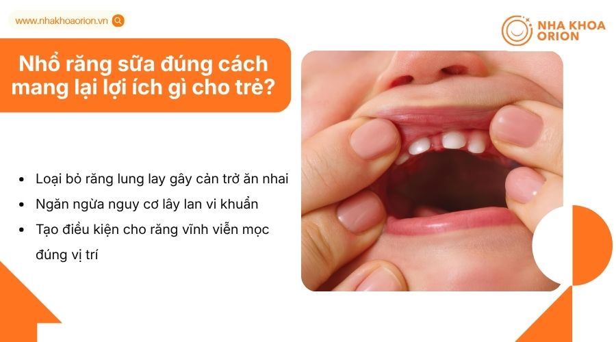 Nhổ răng sữa đ&uacute;ng thời điểm gi&uacute;p răng vĩnh viễn mọc đều, khỏe mạnh