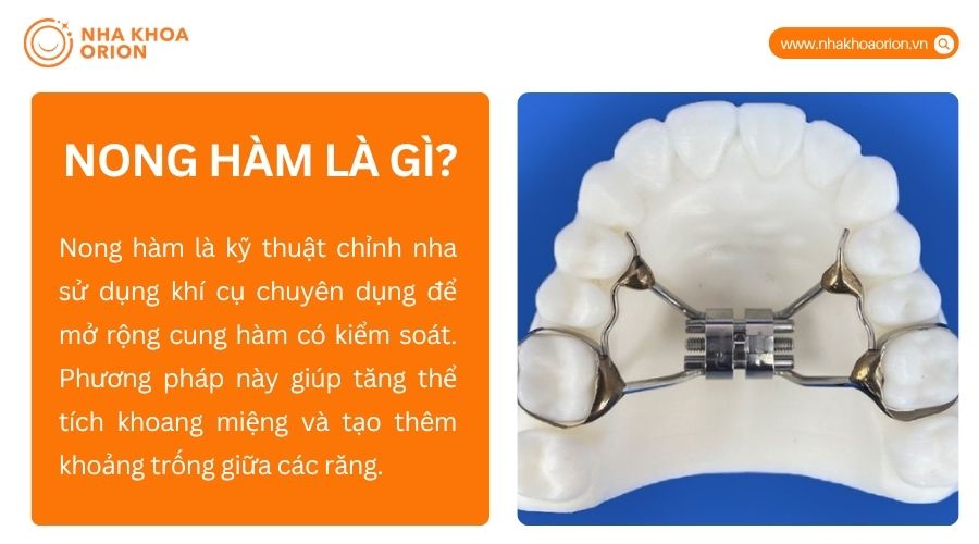 Nong h&agrave;m l&agrave; kỹ thuật d&ugrave;ng kh&iacute; cụ chuy&ecirc;n dụng để mở rộng cung h&agrave;m c&oacute; kiểm so&aacute;t