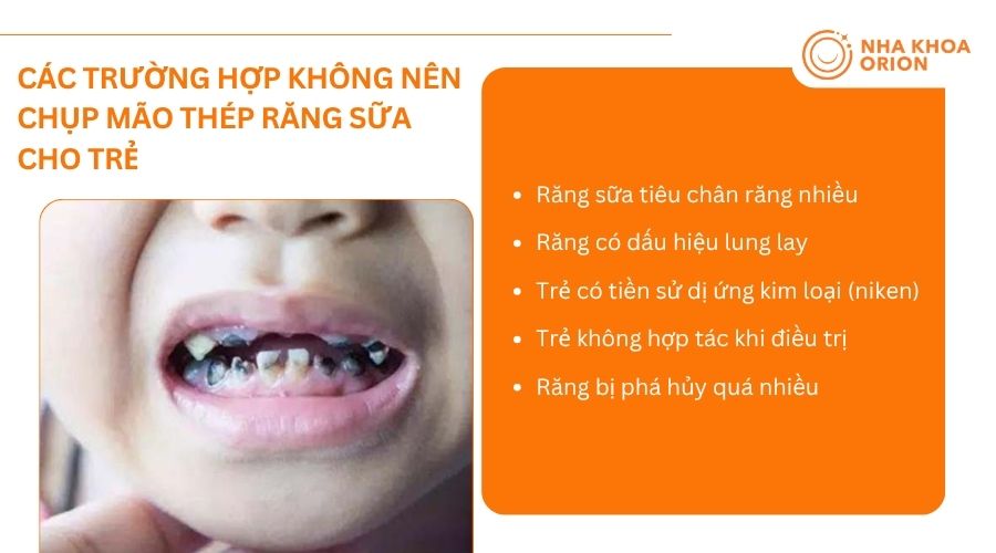 B&aacute;c sĩ cần thăm kh&aacute;m kỹ để x&aacute;c định răng sữa c&oacute; ph&ugrave; hợp chụp m&atilde;o th&eacute;p hay kh&ocirc;ng