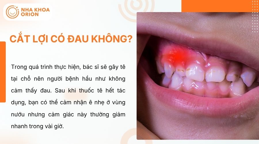 Cắt lợi được g&acirc;y t&ecirc; n&ecirc;n hầu như kh&ocirc;ng đau, chỉ &ecirc; nhẹ sau đ&oacute;