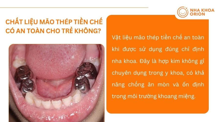M&atilde;o th&eacute;p tiền chế an to&agrave;n, bền chắc v&agrave; ổn định trong m&ocirc;i trường khoang miệng