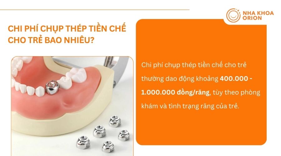 Chi ph&iacute; chụp m&atilde;o th&eacute;p tiền chế cho trẻ dao động từ 400.000 - 1.000.000 đồng/răng