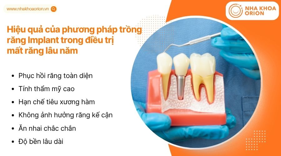 Implant l&agrave; giải ph&aacute;p phục h&igrave;nh tối ưu, t&aacute;i tạo răng ho&agrave;n chỉnh, cải thiện ăn nhai v&agrave; thẩm mỹ