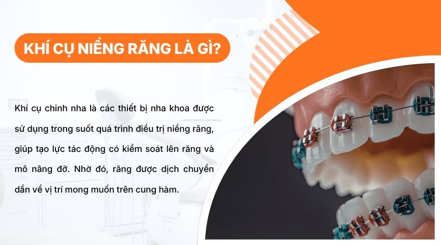 Kh&iacute; cụ chỉnh nha gi&uacute;p tạo lực kiểm so&aacute;t, hỗ trợ dịch chuyển răng về đ&uacute;ng vị tr&iacute;