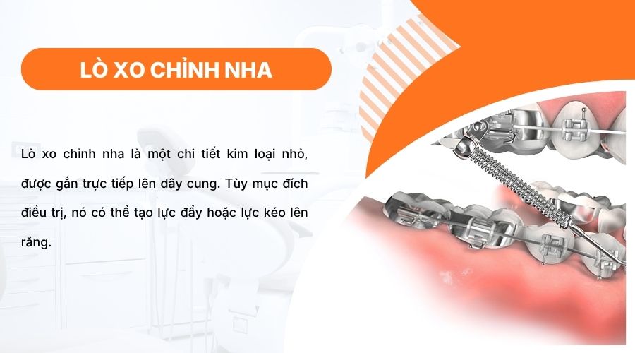 L&ograve; xo chỉnh nha tạo lực đẩy hoặc k&eacute;o, hỗ trợ di chuyển v&agrave; sắp xếp răng ch&iacute;nh x&aacute;c hơn