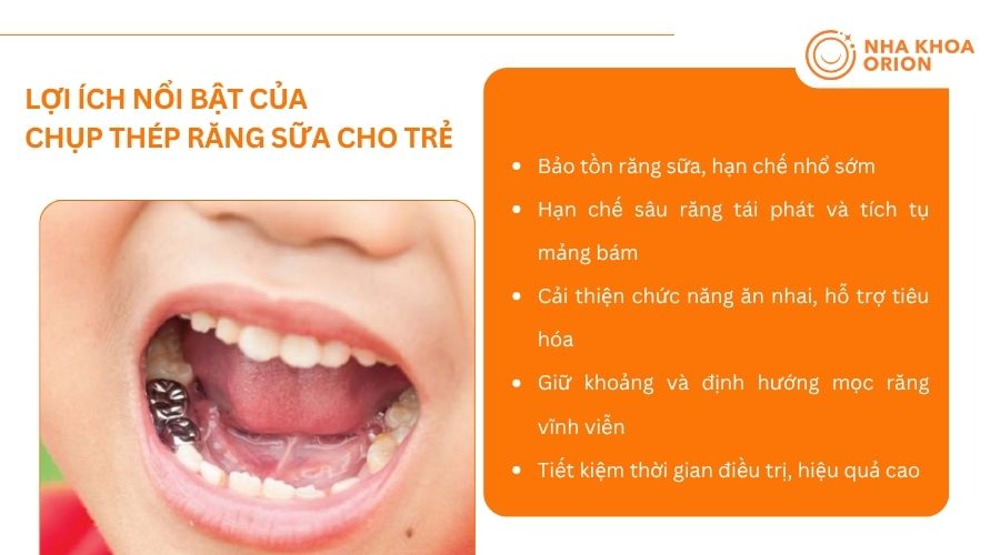 M&atilde;o th&eacute;p gi&uacute;p bảo vệ răng sữa, cải thiện ăn nhai v&agrave; hạn chế s&acirc;u răng ở trẻ