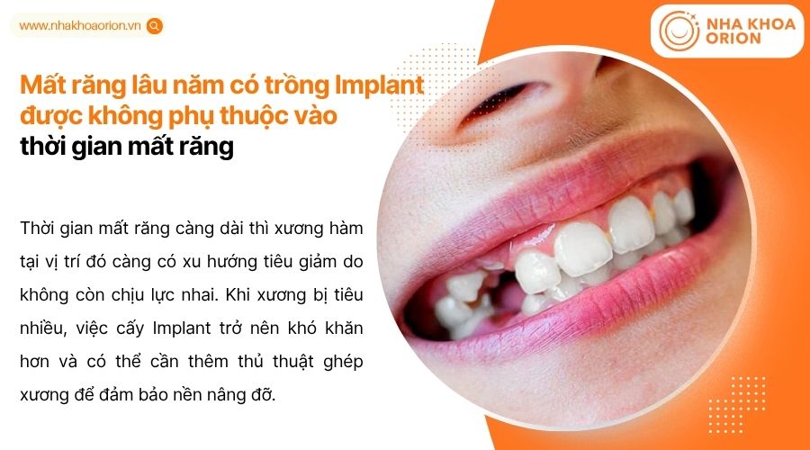 Mất răng l&acirc;u năm g&acirc;y ti&ecirc;u xương h&agrave;m, kh&oacute; cấy Implant v&agrave; giảm khả năng t&iacute;ch hợp