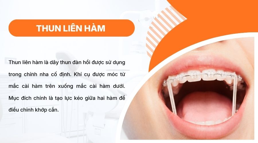 Thun li&ecirc;n h&agrave;m tạo lực k&eacute;o giữa hai h&agrave;m, gi&uacute;p điều chỉnh khớp cắn v&agrave; cải thiện h&agrave;m