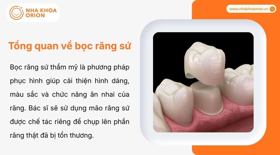 Bọc răng sứ thẩm mỹ gi&uacute;p cải thiện h&igrave;nh d&aacute;ng, m&agrave;u sắc v&agrave; khả năng ăn nhai của răng