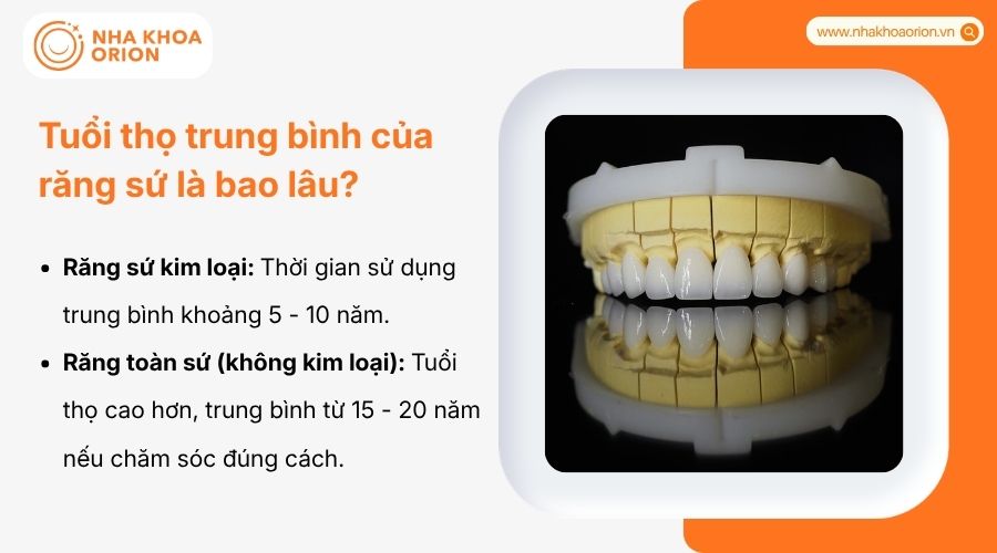 Tuổi thọ răng sứ trung b&igrave;nh từ 5-20 năm t&ugrave;y loại kim loại hoặc to&agrave;n sứ