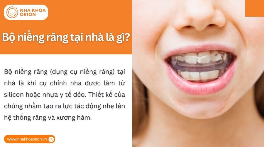 Dụng cụ niềng răng tại nh&agrave; l&agrave; kh&iacute; cụ gi&uacute;p định hướng răng mọc đ&uacute;ng vị tr&iacute;