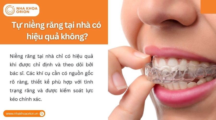 Niềng răng tại nh&agrave; hiệu quả khi c&oacute; b&aacute;c sĩ chỉ định v&agrave; kiểm so&aacute;t lực ch&iacute;nh x&aacute;c