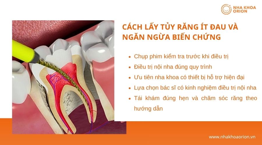 C&aacute;c yếu tố gi&uacute;p qu&aacute; tr&igrave;nh điều trị tủy răng diễn ra nhẹ nh&agrave;ng v&agrave; an to&agrave;n