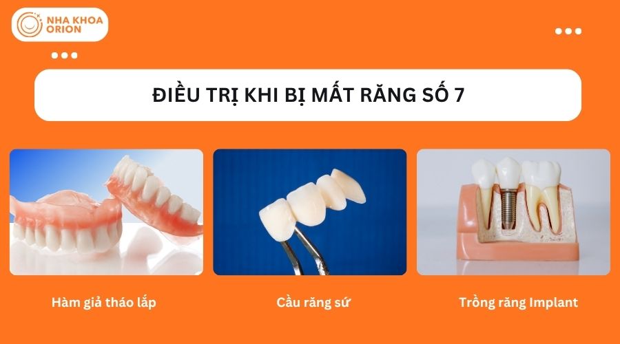 Các phương pháp điều trị răng số 7 bị hư