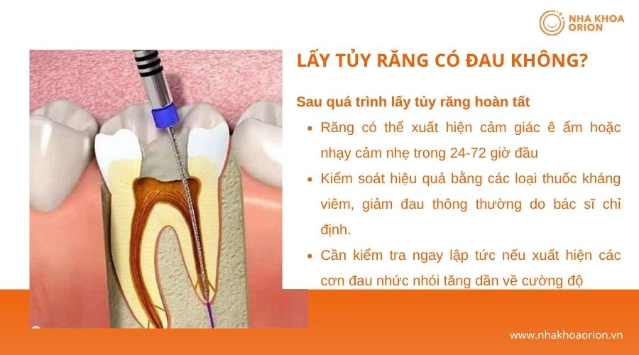Sau lấy tủy răng, &ecirc; nhẹ 24-72 giờ đầu thường l&agrave; phản ứng b&igrave;nh thường v&agrave; sẽ giảm dần