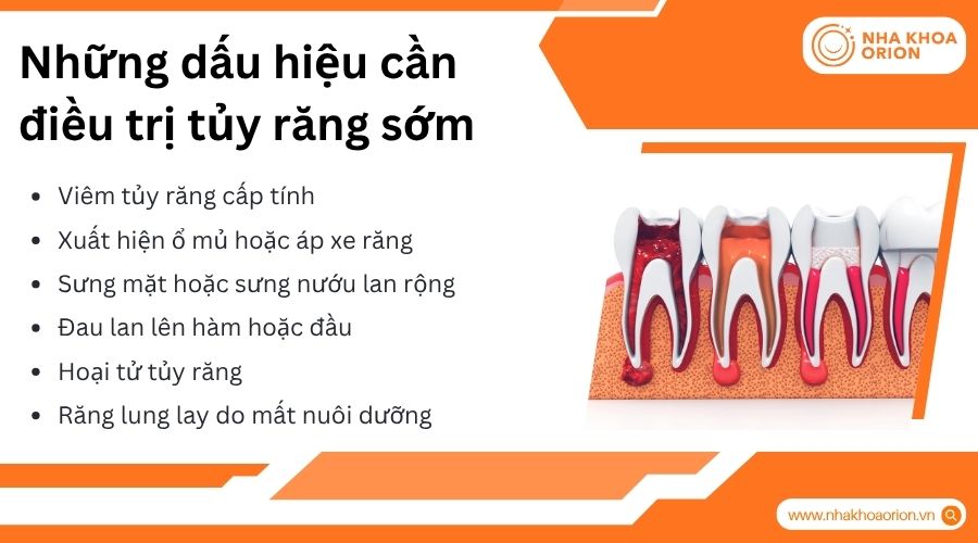 Nhận biết sớm dấu hiệu vi&ecirc;m tủy gi&uacute;p điều trị kịp thời v&agrave; bảo tồn răng hiệu quả