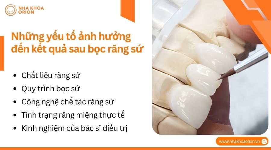 Chất liệu sứ và tay nghề bác sĩ quyết định độ bền sau bọc răng sứ