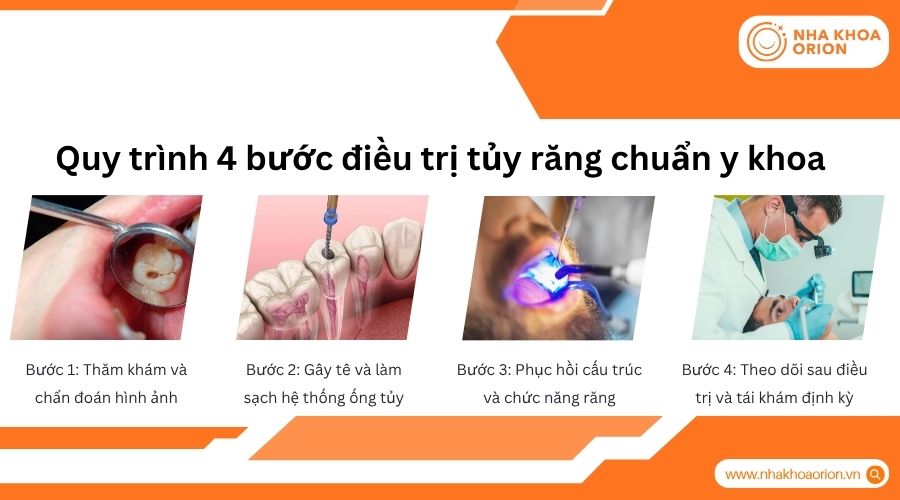 Quy tr&igrave;nh điều trị tủy chuẩn gi&uacute;p loại bỏ nhiễm tr&ugrave;ng v&agrave; bảo tồn răng l&acirc;u d&agrave;i