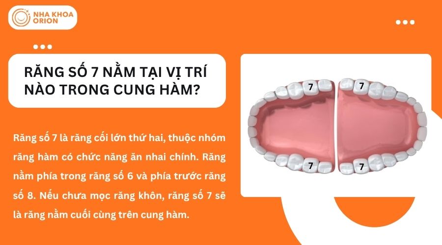 Răng số 7 nằm ở vị trí nào trên cung hàm?
