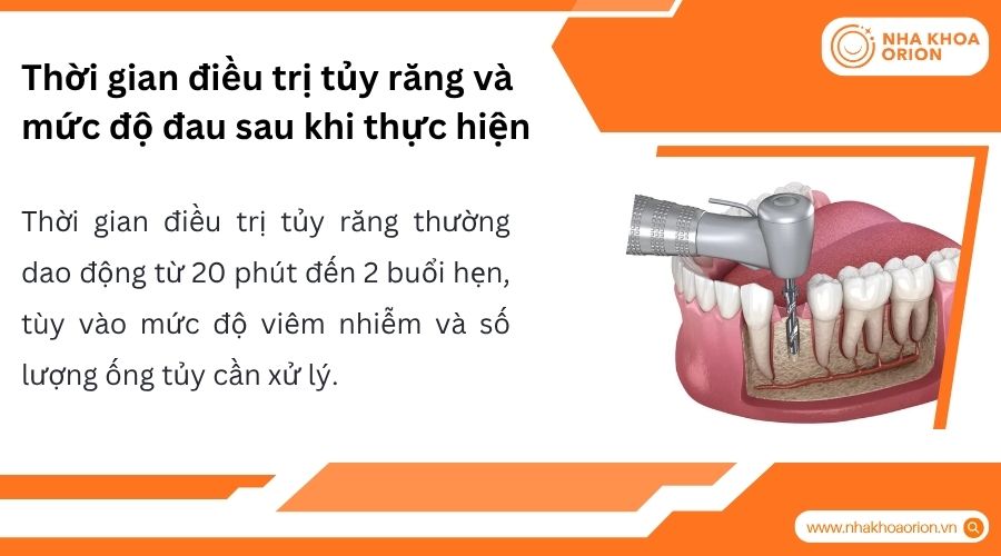 Thời gian điều trị tủy phụ thuộc mức độ vi&ecirc;m v&agrave; số lượng ống tủy cần xử l&yacute;