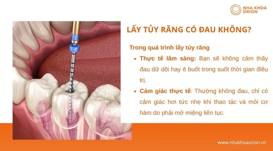 Lấy tủy răng thường kh&ocirc;ng g&acirc;y đau nhiều nhờ g&acirc;y t&ecirc;, chỉ hơi tức nhẹ khi thao t&aacute;c 