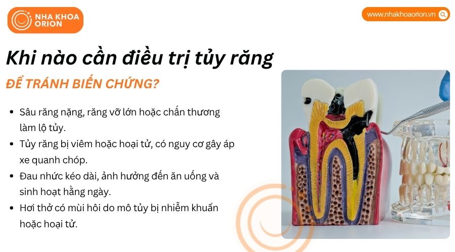 Tủy răng viêm kéo dài có thể gây đau nhức và ảnh hưởng khả năng ăn nhai