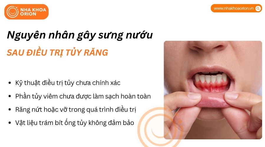 Sưng nướu sau điều trị tủy có thể liên quan đến viêm nhiễm hoặc tổn thương chân răng