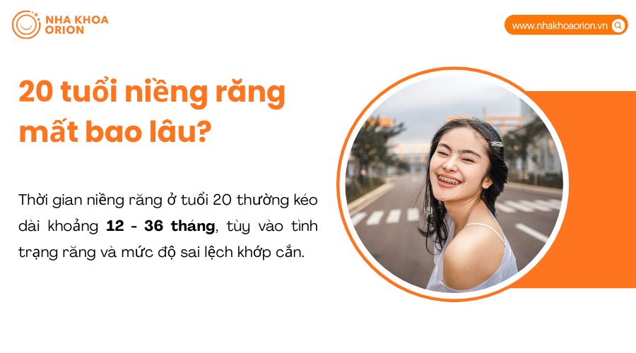 20 tuổi niềng răng mất bao lâu
