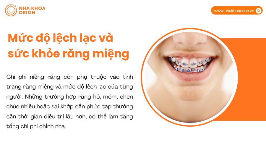 Tình trạng lệch lạc của răng ảnh hưởng trực tiếp đến thời gian và chi phí chỉnh nha