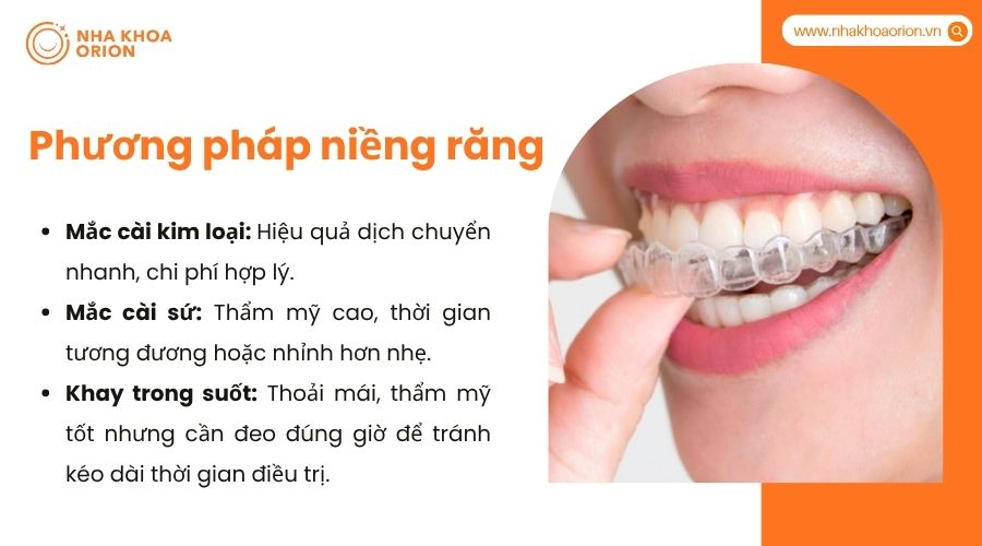 Phương pháp niềng răng