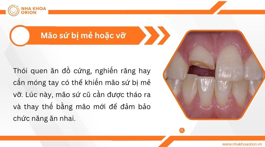M&atilde;o sứ bị nứt, mẻ hoặc vỡ