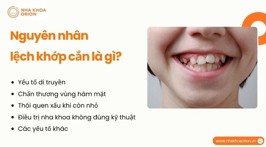 Các nguyên nhân phổ biến gây sai lệch khớp cắn trong quá trình phát triển răng hàm